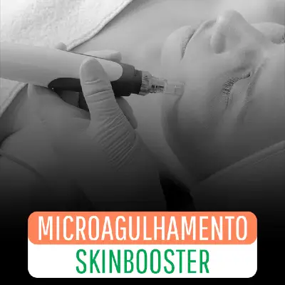 Microagulhamento Skin booster